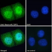 abx430837 (1 µg/ml) staining of Human Brain (Cerebellum) lysate (35 µg protein in RIPA buffer). Primary incubation was 1 hour. Detected by chemiluminescence.