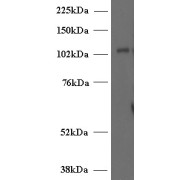 abx430844 (2 µg/ml) staining of Human T-lymphocyte lysate (35 µg protein in RIPA buffer). Detected by chemiluminescence.