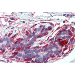 Erythrocyte Membrane Protein Band 4.1 Like 2 (EPB41L2) Antibody