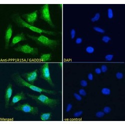 Protein Phosphatase 1, Regulatory Subunit 15A (PPP1R15A) Antibody