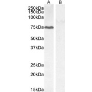 abx430859 (0.3 µg/ml) staining of HepG2 (A) and negative control KLY (B) lysate (35 µg protein in RIPA buffer) Detected by chemiluminescence.