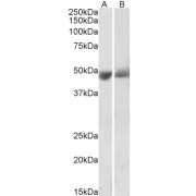abx430860