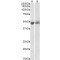 Pigment Epithelium-Derived Factor / PEDF (SERPINF1) Antibody