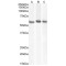 Coronin 1 (CORO1A) Antibody