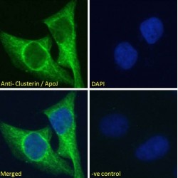 Clusterin (CLU) Antibody