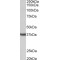 Clusterin (CLU) Antibody