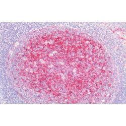 Clusterin (CLU) Antibody