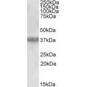 abx430878 (0.03 µg/ml) staining of Human Prostate lysate (35 µg protein in RIPA buffer). Primary incubation was 1 hour. Detected by chemiluminescence.