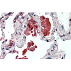 Insulysin Antibody