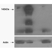 HEK293 overexpressing TANK1 (lane 2) and TANK2 (lane 4) and probed with abx430893 (mock transfection in first lane). Lane three is empty. Lower panel shows the same lysates probed for alpha-Actin to show protein levels. Primary incubation (0.5 µg/ml) was overnight at 4°C. Detected by chemiluminescence.