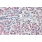 Prealbumin Protein (PALB) Antibody