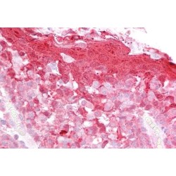 Cystatin B (CSTB) Antibody