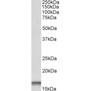 abx430904 (0.1 µg/ml) staining of Human Lungs (35 µg protein in RIPA buffer). Primary incubation was 1 hour. Detected by chemiluminescence.