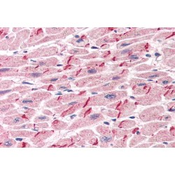 Plakoglobin Antibody