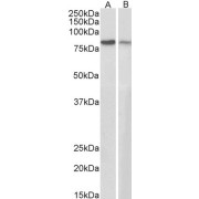 abx430913 staining (1 µg/ml) of Rat Eye lysate (RIPA buffer, 35 µg total protein per lane). Primary incubated for 1 hour. Detected by chemiluminescence.