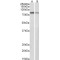 Plakoglobin Antibody