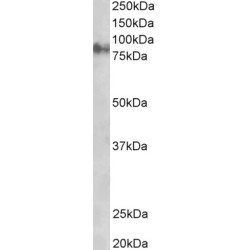 Plakoglobin Antibody