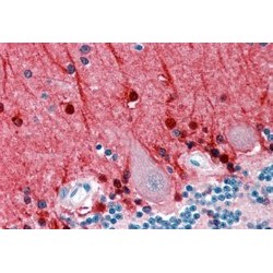 Amphiphysin (AMPH) Antibody