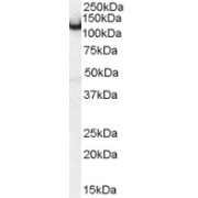 abx430917