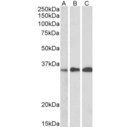 abx430920 (0.5 µg/ml) staining of Human Thymus, Human Lymph node and Human Tonsil lysate (35 µg protein in RIPA buffer). Detected by chemiluminescence.