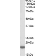 abx430934 (0.3 µg/ml) staining of Rat Brain lysate (35 µg protein in RIPA buffer). Primary incubation was 1 hour. Detected by chemiluminescence.