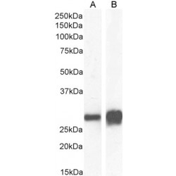 14-3-3 Sigma (SFN) Antibody