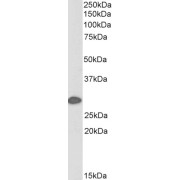 abx430936