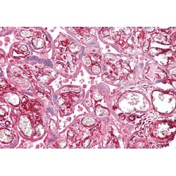 tropomyosin 4 (TPM4) Antibody