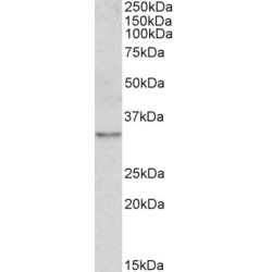tropomyosin 4 (TPM4) Antibody