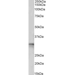 tropomyosin 4 (TPM4) Antibody