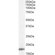 abx430946 (0.1 µg/ml) staining of Human Lymph Node lysate (35 µg protein in RIPA buffer). Detected by chemiluminescence.