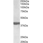 abx430947 (0.3 µg/ml) staining of Human Frontal Cortex lysate (35 µg protein in RIPA buffer). Primary incubation was 1 hour. Detected by chemiluminescence.