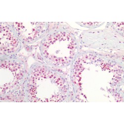 Nucleophosmin (NPM1) Antibody