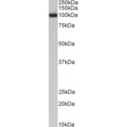 abx430954 (1 µg/ml) staining of Peripheral Blood Lymphocytes lysate (35 µg protein in RIPA buffer). Primary incubation was 1 hour. Detected by chemiluminescence.