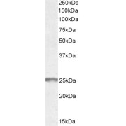 abx430956 (1 µg/ml) staining of Human Muscle lysate (35 µg protein in RIPA buffer). Detected by chemiluminescence.