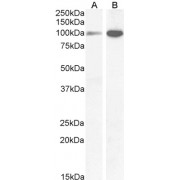 abx430957 (1 µg/ml) staining of Human Amylgada (A) and Rat (B) Brain lysate (35 µg protein in RIPA buffer). Detected by chemiluminescence.