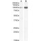 NMDA receptor 1 Antibody