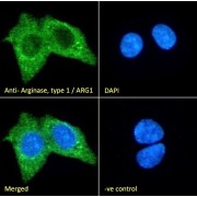 IF analysis of HepG2 cells, using ARG1 Antibody (10ug/ml) with a secondary antibody conjugated to AF488 (2ug/ml), showing cytoplasmic staining. Blue DAPI was used as a nuclear stain. Non-specific Goat IgG antibody was used a a negative control (10ug/ml) with a secondary antibody conjugated to AF488 (2ug/ml).