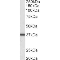 Arginase 1 (ARG1) Antibody