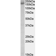 abx430966 (0.03 µg/ml) staining of K562 lysate (35 µg protein in RIPA buffer). Primary incubation was 1 hour. Detected by chemiluminescence.