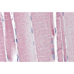 Mitochondrial Uncoupling Protein 2 (UCP2) Antibody
