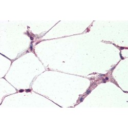 Mitochondrial Uncoupling Protein 2 (UCP2) Antibody