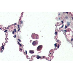 Mitochondrial Uncoupling Protein 2 (UCP2) Antibody