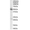 Pyruvate Dehydrogenase (PDH) Antibody
