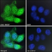 Immunofluorescence analysis of paraformaldehyde fixed HepG2 cells, permeabilized with 0.15% Triton. Primary incubation 1hr (10 µg/ml) followed by AF488 secondary antibody (2 µg/ml), showing nuclear and cytoplasmic staining. The nuclear stain is DAPI (blue). Negative control: Unimmunized goat IgG (10 µg/ml) followed by AF488 secondary antibody (2 µg/ml).