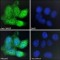 Wiskott-Aldrich Syndrome Protein (WAS) Antibody
