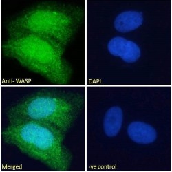 Wiskott-Aldrich Syndrome Protein (WAS) Antibody