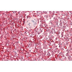 Wiskott-Aldrich Syndrome Protein (WAS) Antibody