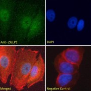 abx430995 Immunofluorescence analysis of paraformaldehyde fixed MCF7 cells, permeabilized with 0.15% Triton. Primary incubation 1hr (10 µg/ml) followed by AF488 secondary antibody (2 µg/ml), showing nuclear and vesicle staining. Actin filaments were stained with phalloidin (red) and the nuclear stain is DAPI (blue). Negative control: Unimmunized goat IgG (10 µg/ml) followed by AF488 secondary antibody (2 µg/ml).