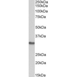 Microtubule Associated Protein RP/EB Family Member 3 (MAPRE3) Antibody